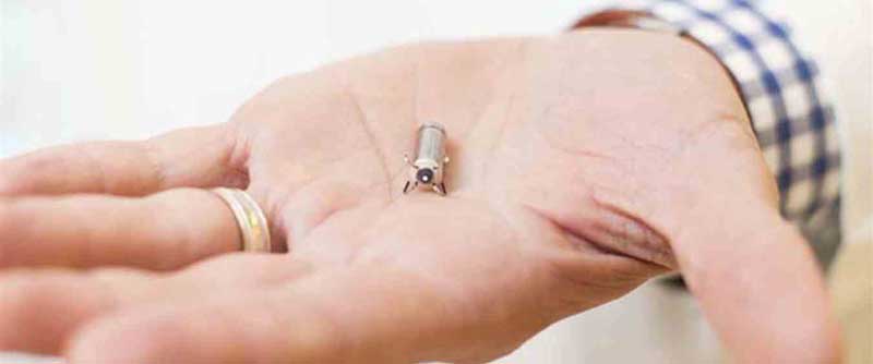 il pacemaker più piccolo al mondo